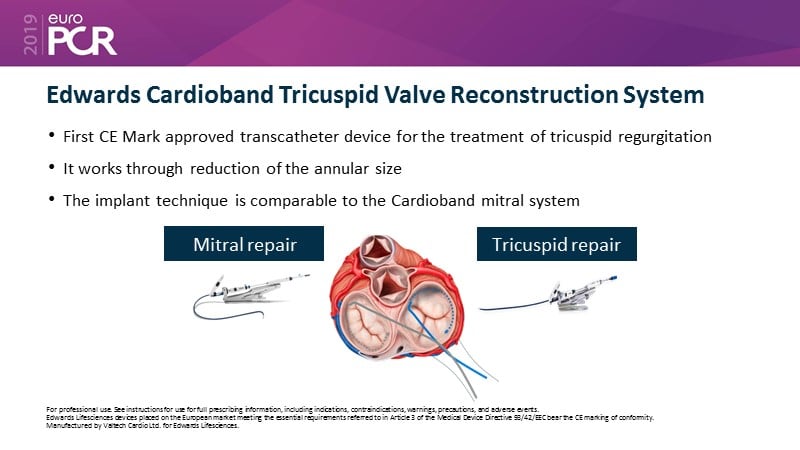 Addressing tricuspid regurgitation with annular reduction: the ...