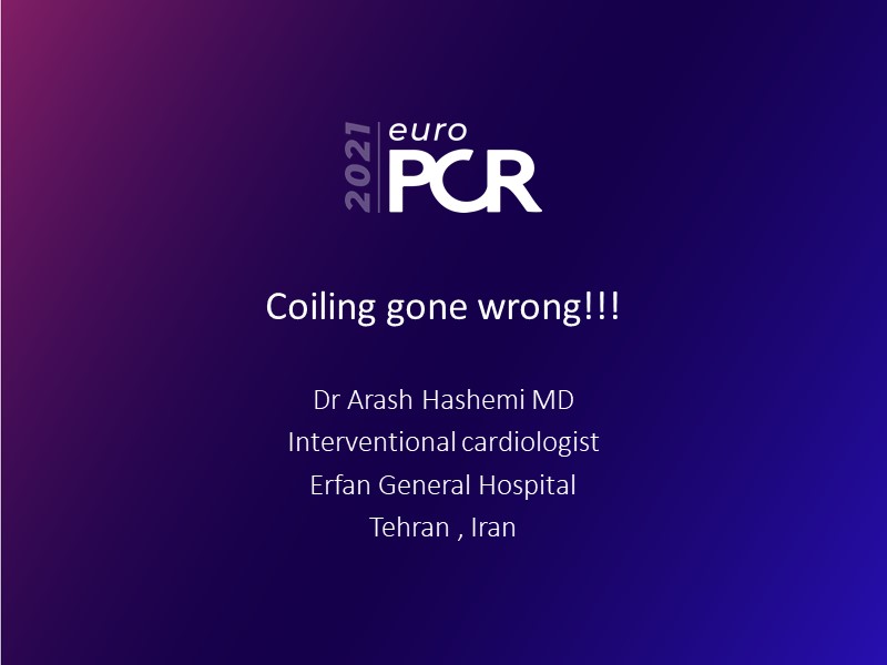 Rota-Staged PCI in a Patient with Acute STEMI and an calcified coronary ...