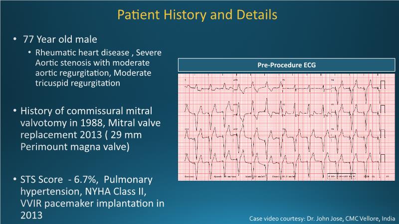 Next generation balloon expandable TAVR and thin strut BRS - Science ...