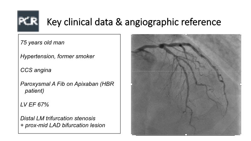 Left Main And Complex Bifurcation Stenting