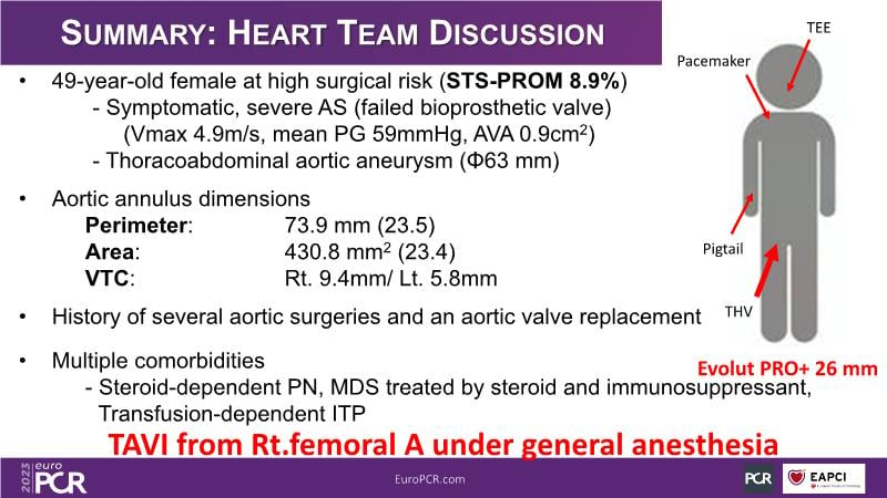 Meaningful Innovations In Interventional Cardiology