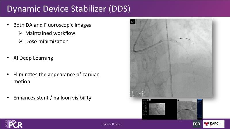 Meaningful Innovations In Interventional Cardiology