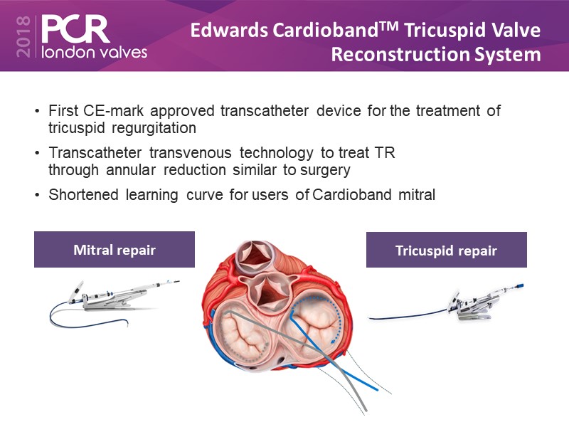 Reducing mitral and tricuspid regurgitation through annular reduction ...