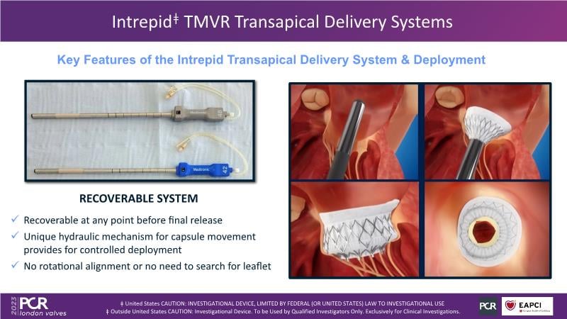 An intrepid solution for transfemoral treatment of mitral regurgitation